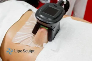 Are The Results From Aqualyx Permanent? 4 Compare Aqualyx Aylestone to other fat reduction treatments.
