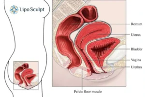 Treatment For A Leaky Bladder 2 How EM Chair treatment Aylestone can help Leaky bladder issues. Read more now!