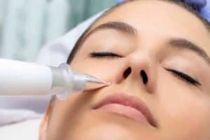 Best Actinic Keratoses Removal 3 Actinic keratoses Aylestone solutions - book in today!