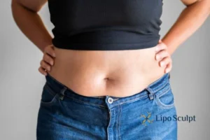 Bidding Farewell to Muffin Tops with Aqualyx Fat Injections 2 Do you wish you could reduce your muffin top Aylestone With Aqualy fat dissolving injections you can!